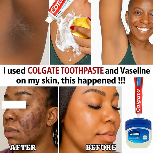 Colgate Toothpaste for Face Whitening