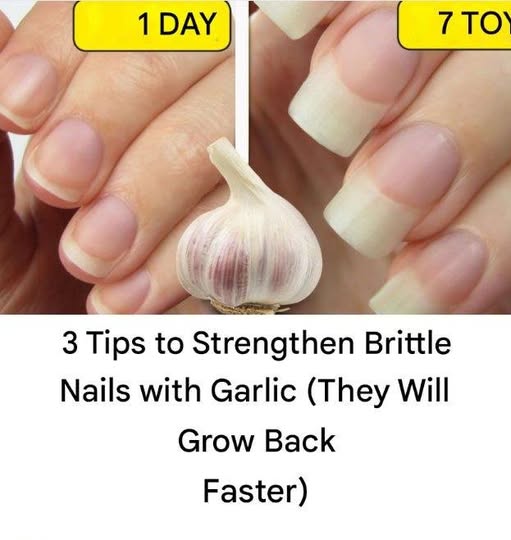 3 Tips to Strengthen Brittle Nails