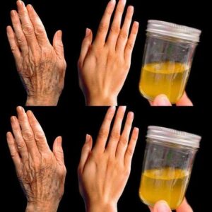 Collagen Stimulation For Wrinkles