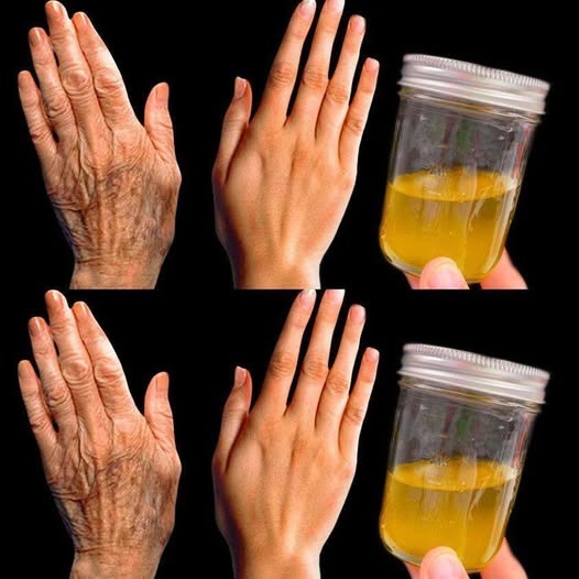 Collagen Stimulation For Wrinkles