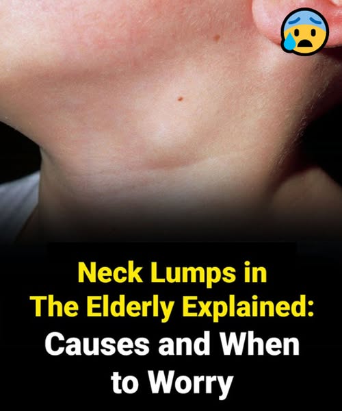Seniors Don’t Ignore a Neck Lump