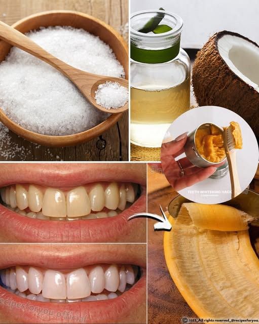 4 Powerful And Natural Tips To Whiten Your Teeth At Home