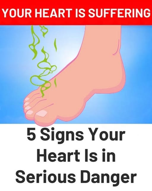 5 Signs Your Heart Is In Serious Danger