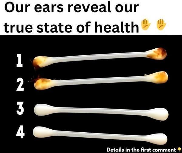 Ears Reveal Our True Self